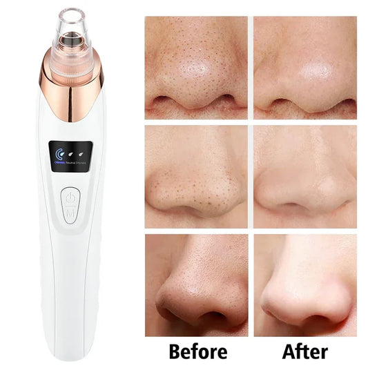 Blackhead Remover Vacuum